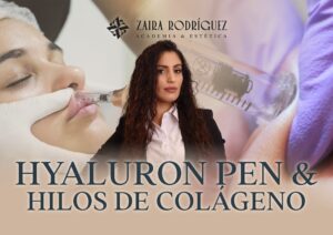 Hyaluron Pen + Hilos de Colágeno