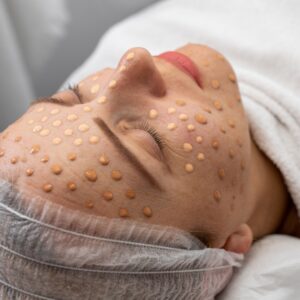 Dermapen Vitaminas + Bb Glow
