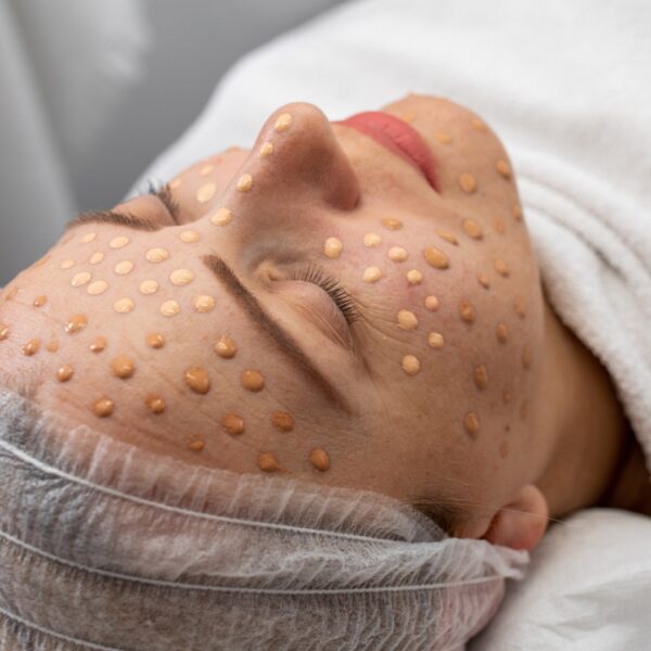 Dermapen Vitaminas + Bb Glow