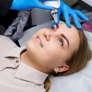 Eliminar Micropigmentación