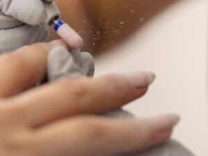Retirada de uñas completa